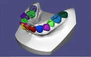 歯のセグメンテーション(歯の抽出処理)を自動化する技術を開発