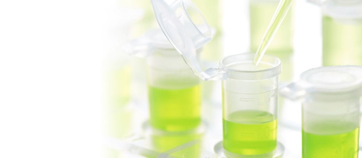 【製品開発ストーリー】1.5ML平底チューブ